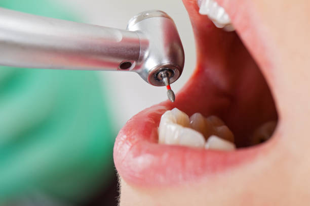 Best Pediatric Emergency Dentist in Mays Chapel, MD
